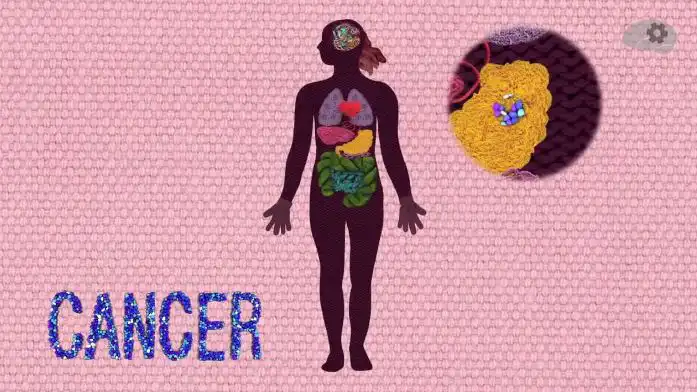 Health and Facts Tips Cancer Treatment and Prevention Advice From Health Experts