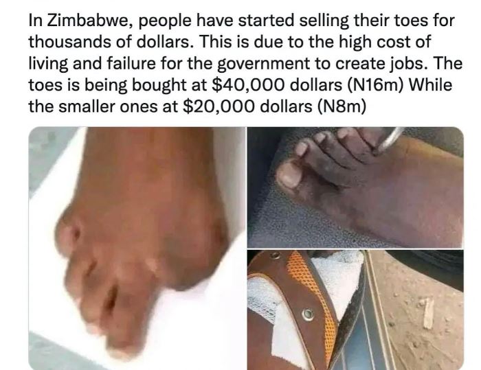 A Toe for $25,000$ as Zimbabweans find CASH cow out of poverty [Facts Checked]