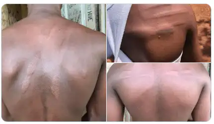 Agogo State College student abused and deformed with countless lashes by teacher
