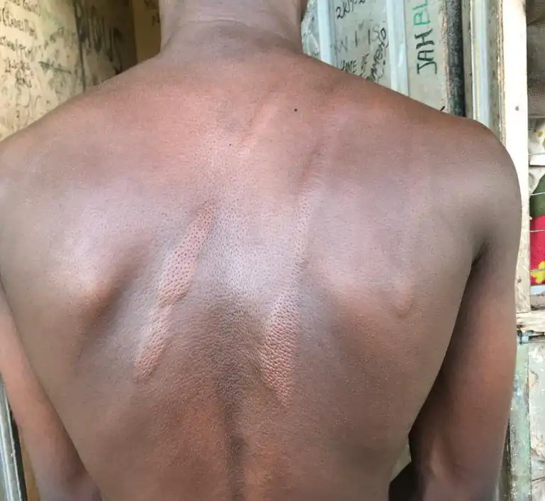 News coming in from an informant indicates a teacher in Agogo state college has abused a student mercilessly, leading to bruises and deformation of the back of the student.