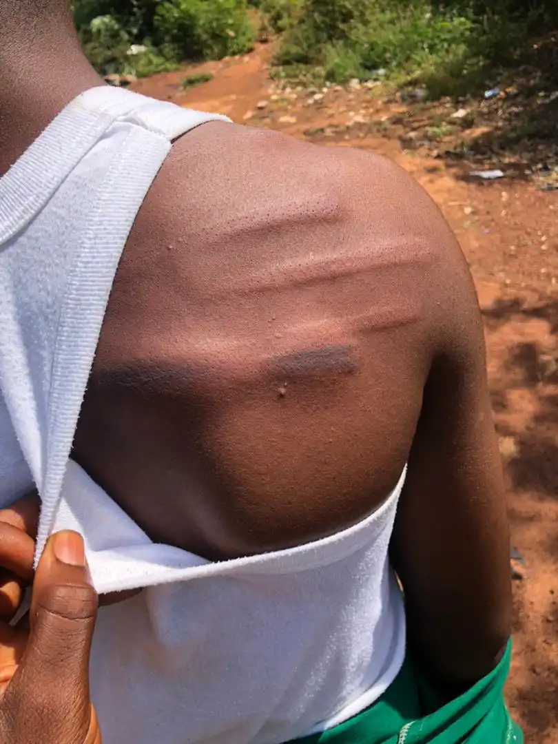 News coming in from an informant indicates a teacher in Agogo state college has abused a student mercilessly, leading to bruises and deformation of the back of the student.