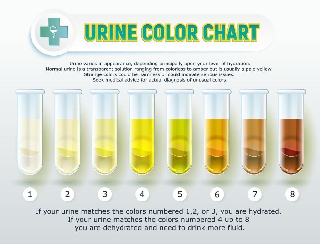 What You Should Know About Your Urine Color And When to see a Doctor