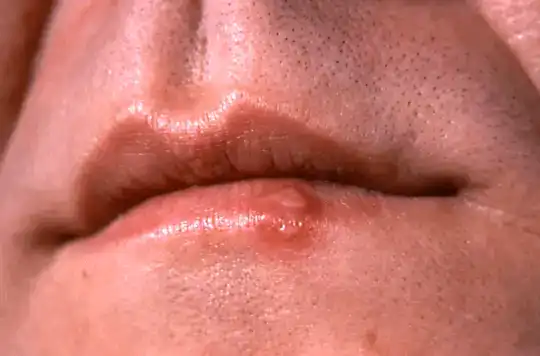 causes of frequent urination