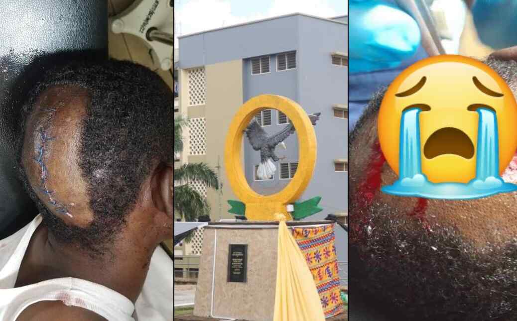 VIDEO: AAMUSTED Level 100 Student Reportedly Dead After Being Attacked By Armed Robbers