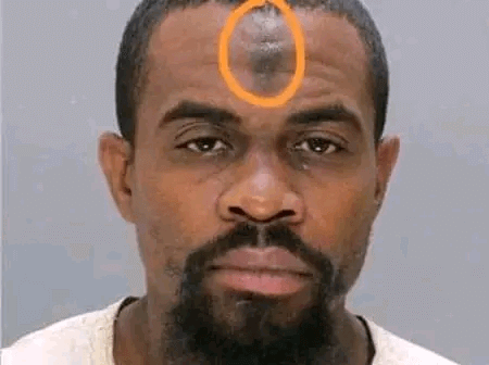 Reason Behind The Dark Spot On Muslim's Forehead