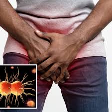 All you need to know about Gonorrhoea, its causes, effects, and treatment Lecturer contracts Gono from level 100 female student, vows to fail her