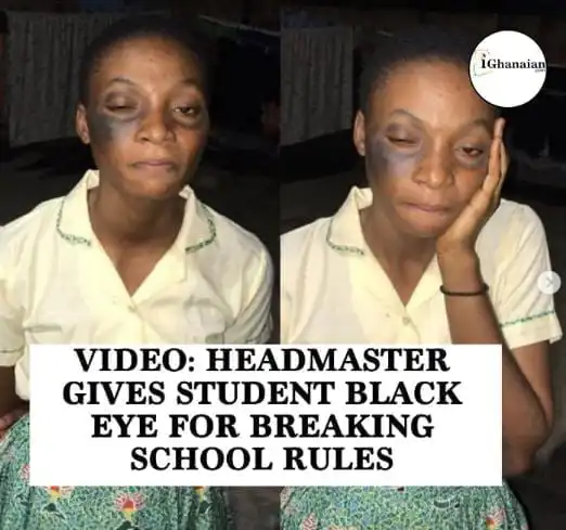 Headmaster of allegedly slaps female student, gives here black eye (Full Details)