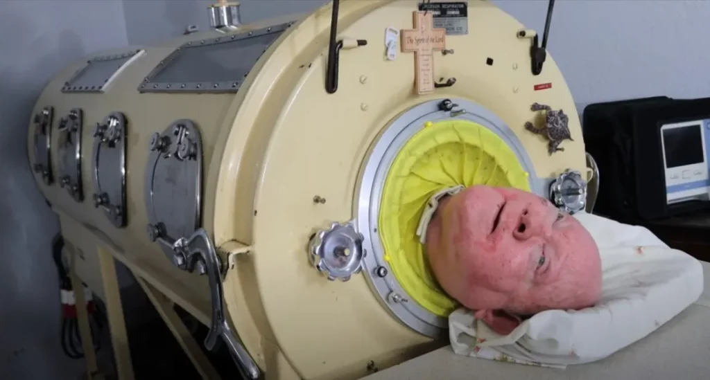 Paul Alexander, Man in the iron lung dies after living in tank for 70 years